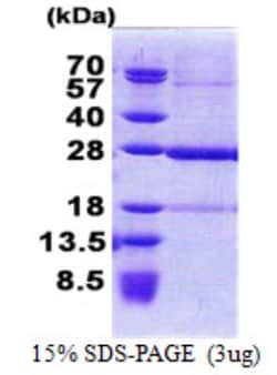 Novus Biologicals&trade;&nbsp;Recombinant Human KxDL motif containing 1 His Protein