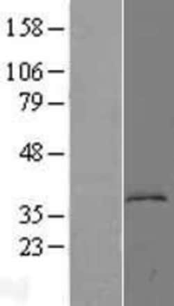 Novus Biologicals&trade;&nbsp;Kynureninase Overexpression Lysate
