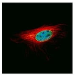 L3MBTL1 Antibody, Novus Biologicals 0.1mL; Unlabeled:Antibodies, Polyclonal