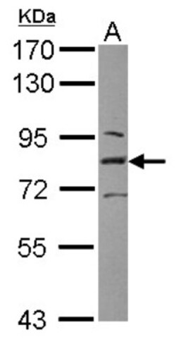 L3MBTL1 Antibody, Novus Biologicals 0.1mL; Unlabeled:Antibodies, Polyclonal