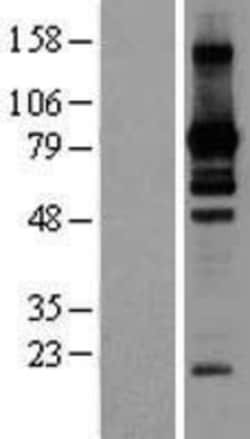 Novus Biologicals&trade;&nbsp;L3MBTL2 Overexpression Lysate