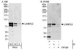 L3MBTL2 Antibody, Novus Biologicals 0.1mL; Unlabeled:Antibodies, Polyclonal