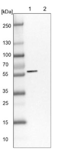 LACE1 Antibody, Novus Biologicals 0.1mL; Unlabeled:Antibodies, Polyclonal