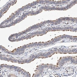 LACE1 Antibody, Novus Biologicals 0.1mL; Unlabeled:Antibodies, Polyclonal