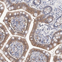 LACE1 Antibody, Novus Biologicals:Antibodies:Primary Antibodies
