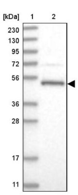 LACE1 Antibody, Novus Biologicals 0.1mL; Unlabeled:Antibodies, Polyclonal