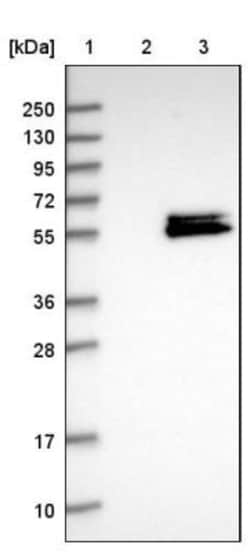 LACE1 Antibody, Novus Biologicals:Antibodies:Primary Antibodies