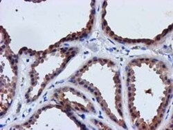 lactamase, beta 2 Antibody (OTI2F9), Novus Biologicals 0.1mL; Unlabeled:Antibodies,