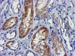 lactamase, beta 2 Antibody (OTI2F9), Novus Biologicals 0.1mL; Unlabeled:Antibodies,