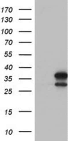 lactamase, beta 2 Antibody (OTI2F9), Novus Biologicals 0.1mL; Unlabeled:Antibodies,