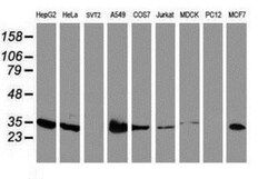 lactamase, beta 2 Antibody (OTI2F9), Novus Biologicals 0.1mL; Unlabeled:Antibodies,