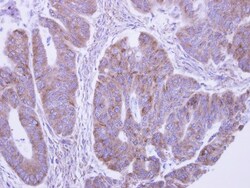 lactamase, beta 2 Antibody, Novus Biologicals 0.1mL; Unlabeled:Antibodies,