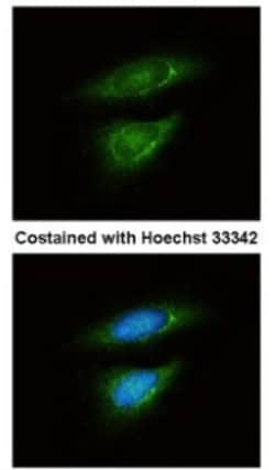 Lactate Dehydrogenase B Antibody, Novus Biologicals 0.1mL; Unlabeled:Antibodies,