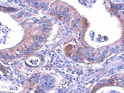 Lactate Dehydrogenase B Antibody, Novus Biologicals 0.1mL; Unlabeled:Antibodies,