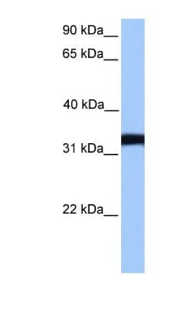 Lactate Dehydrogenase C Antibody, Novus Biologicals 100&mu;L; Unlabeled:Antibodies,