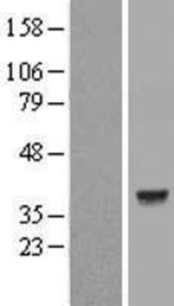 Novus Biologicals&trade;&nbsp;Lactate Dehydrogenase C Overexpression Lysate