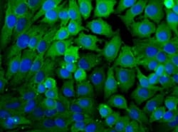 Lactate Dehydrogenase A/LDHA Antibody - BSA Free, Novus Biologicals:Antibodies:Primary