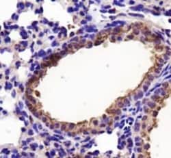 Lactate Dehydrogenase A/LDHA Antibody - BSA Free, Novus Biologicals:Antibodies:Primary