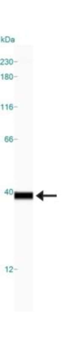 Lactate Dehydrogenase A/LDHA Antibody - BSA Free, Novus Biologicals:Antibodies:Primary