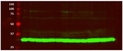Lactate Dehydrogenase A/LDHA Antibody - BSA Free, Novus Biologicals:Antibodies:Primary