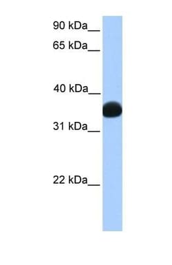 Lactate Dehydrogenase B Antibody, Novus Biologicals 0.05mg; Unlabeled:Antibodies,