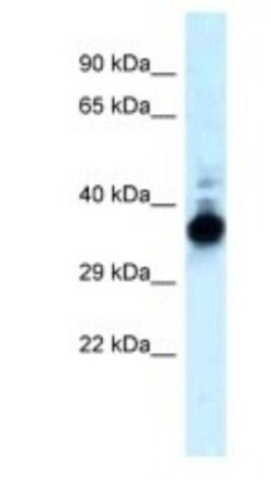 Lactate Dehydrogenase B Antibody, Novus Biologicals 0.05mg; Unlabeled:Antibodies,