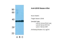 Lactate Dehydrogenase B Antibody, Novus Biologicals 0.05mg; Unlabeled:Antibodies,
