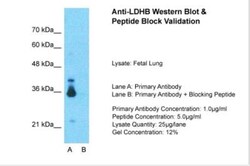 Lactate Dehydrogenase B Antibody, Novus Biologicals 0.05mg; Unlabeled:Antibodies,