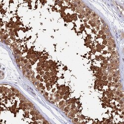 Lactate Dehydrogenase C Antibody, Novus Biologicals 0.1mL; Unlabeled:Antibodies,