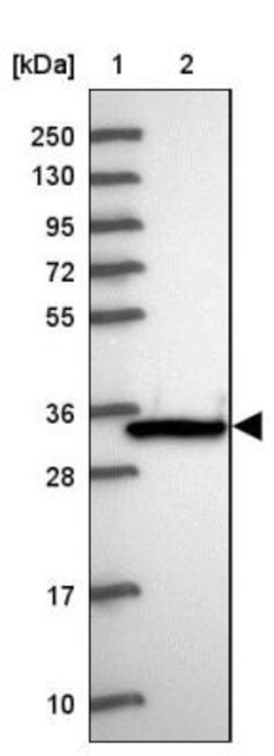 Lactate Dehydrogenase C Antibody, Novus Biologicals 0.1mL; Unlabeled:Antibodies,