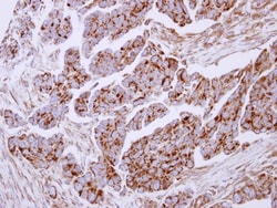 Lactoferrin Antibody, Novus Biologicals 0.1mL; Unlabeled:Antibodies, Polyclonal