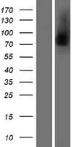 Novus Biologicals&trade;&nbsp;Lactoferrin Overexpression Lysate