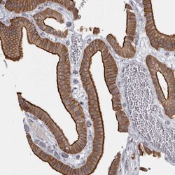 LAD1 Antibody, Novus Biologicals 0.1mL; Unlabeled:Antibodies, Polyclonal
