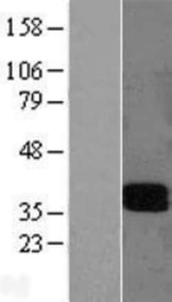 Novus Biologicals™ LAIR1 Overexpression Lysate