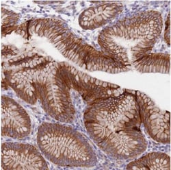 LAMB4 Antibody, Novus Biologicals 25 &mu;L, Unlabeled:Antibodies, Polyclonal