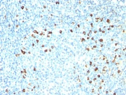 Lambda Light Chain Antibody (ICO-106), Novus Biologicals 0.1mg; Unlabeled:Antibodies