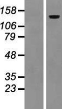 Novus Biologicals&trade;&nbsp;LAMC2 Overexpression Lysate