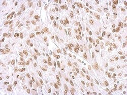 Lamin A + C Antibody, Novus Biologicals 0.1mL; Unlabeled:Antibodies, Polyclonal