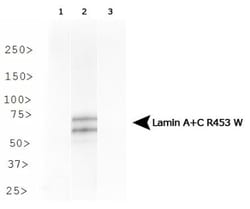 Lamin A + C R453W Antibody (12A-2F5), Novus Biologicals 0.025 mL | Buy Online | Novus Biologicals | Fisher Scientific