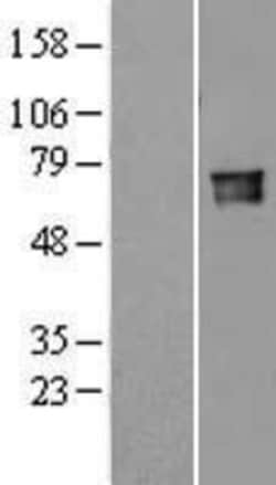 Novus Biologicals™ Lamin B Receptor Overexpression Lysate
