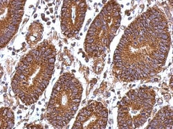 Laminin beta 1 Antibody, Novus Biologicals 0.1mg; Unlabeled:Antibodies,