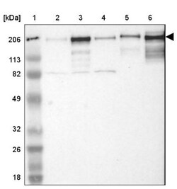 Laminin gamma 1 Antibody, Novus Biologicals 0.1mL; Unlabeled:Antibodies,