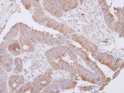 LANCL1 Antibody, Novus Biologicals 0.1mL; Unlabeled:Antibodies, Polyclonal