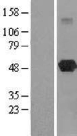 Novus Biologicals™ LANCL2 Overexpression Lysate