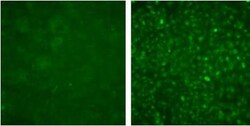 Langerin/CD207 Antibody (310F7.02), Novus Biologicals 0.1mg; Unlabeled:Antibodies,