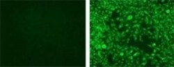 Langerin/CD207 Antibody (918A11), Novus Biologicals 0.1mg; Unlabeled:Antibodies,