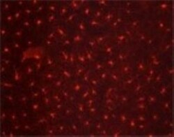 Langerin/CD207 Antibody (918A11), Novus Biologicals 0.1mg; Unlabeled:Antibodies,