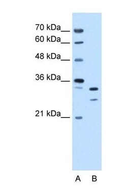 LANPL Antibody, Novus Biologicals 0.05mg; Unlabeled:Antibodies, Polyclonal