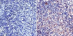 LAP1 Antibody (RL13) - BSA Free, Novus Biologicals 50 &mu;L, Unconjugated:Anticorps,