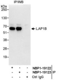 LAP1B Antibody, Novus Biologicals 0.1mL; Unlabeled:Antibodies, Polyclonal
